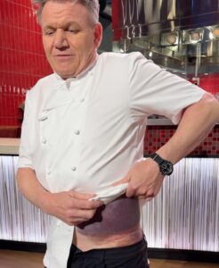 Gordon Ramsay details exactly what caused scary bike accident